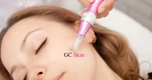 GCSkin benefits of microneedling a guide for a smooth and radiant skin