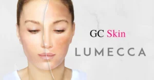Discover the Power of Lumecca IPL: A Safe and Effective Solution for Achieving Radiant Skin at GC Skin