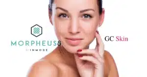 Transform Your Skin with Morpheus8: The Ultimate Rejuvenation Experience