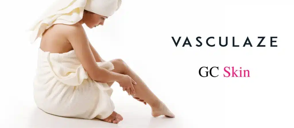 Common questions about Vasculaze