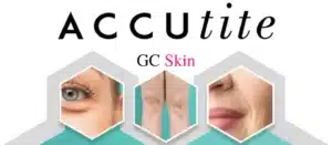 What Areas Can be Treated with AccuTite?
